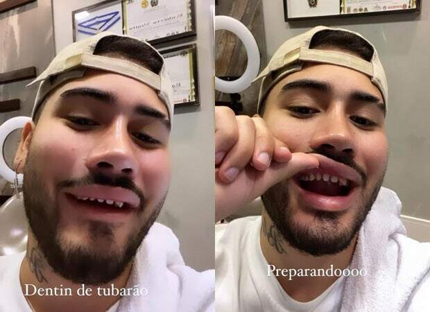 Kevinho mostra dentes sem lente de contato e gera memes na internet - Metropolitana FM