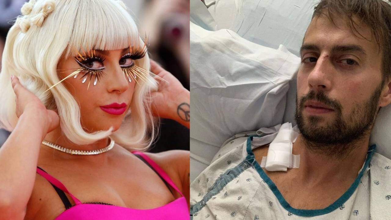 Passeador de cães de Lady Gaga deixa hospital após perder parte dos pulmões - Metropolitana FM