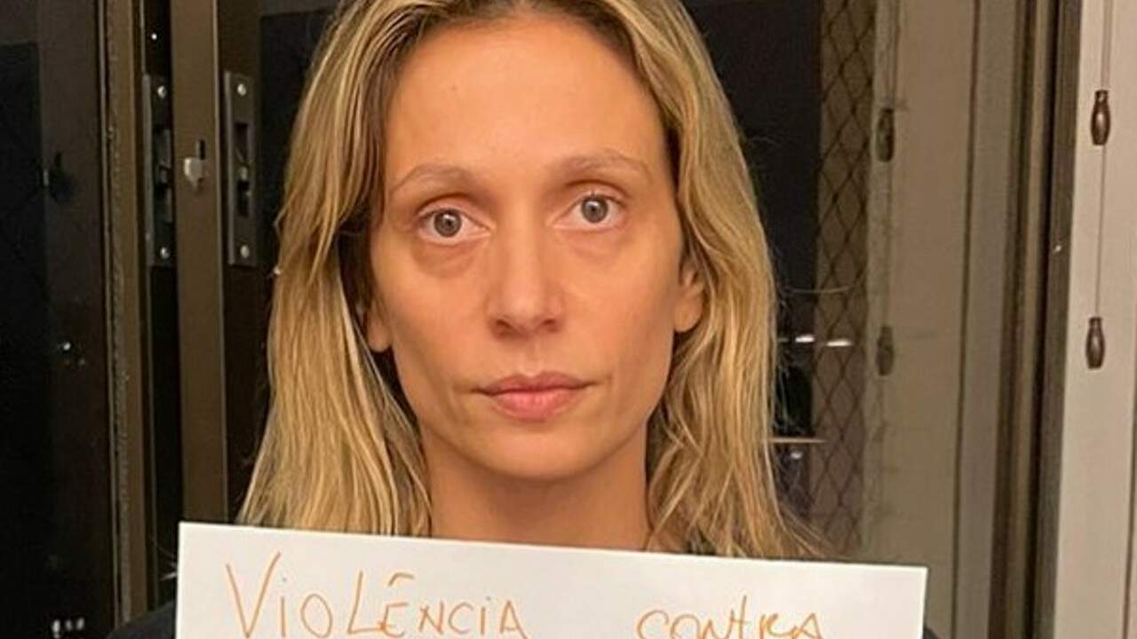 Após caso de violência médica, Luisa Mell acusa ex-marido de ameaçá-la: “Vou lutar” - Metropolitana FM