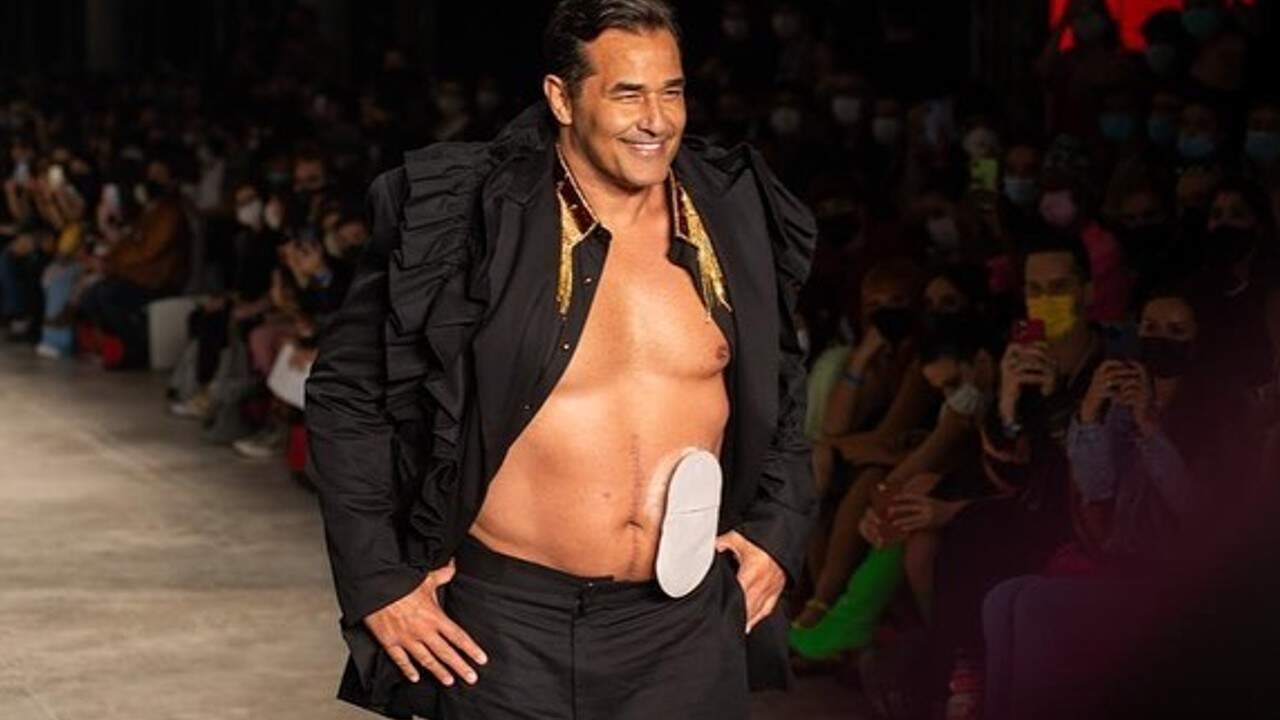Luciano Szafir desfila com bolsa de estomia na SPFW: “Estomia não define ninguém”