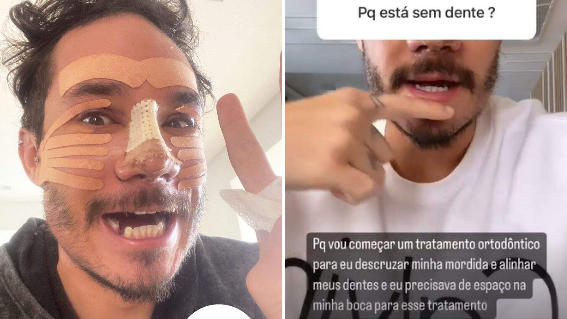 Stories de Eliezer (reprodução Instagram)