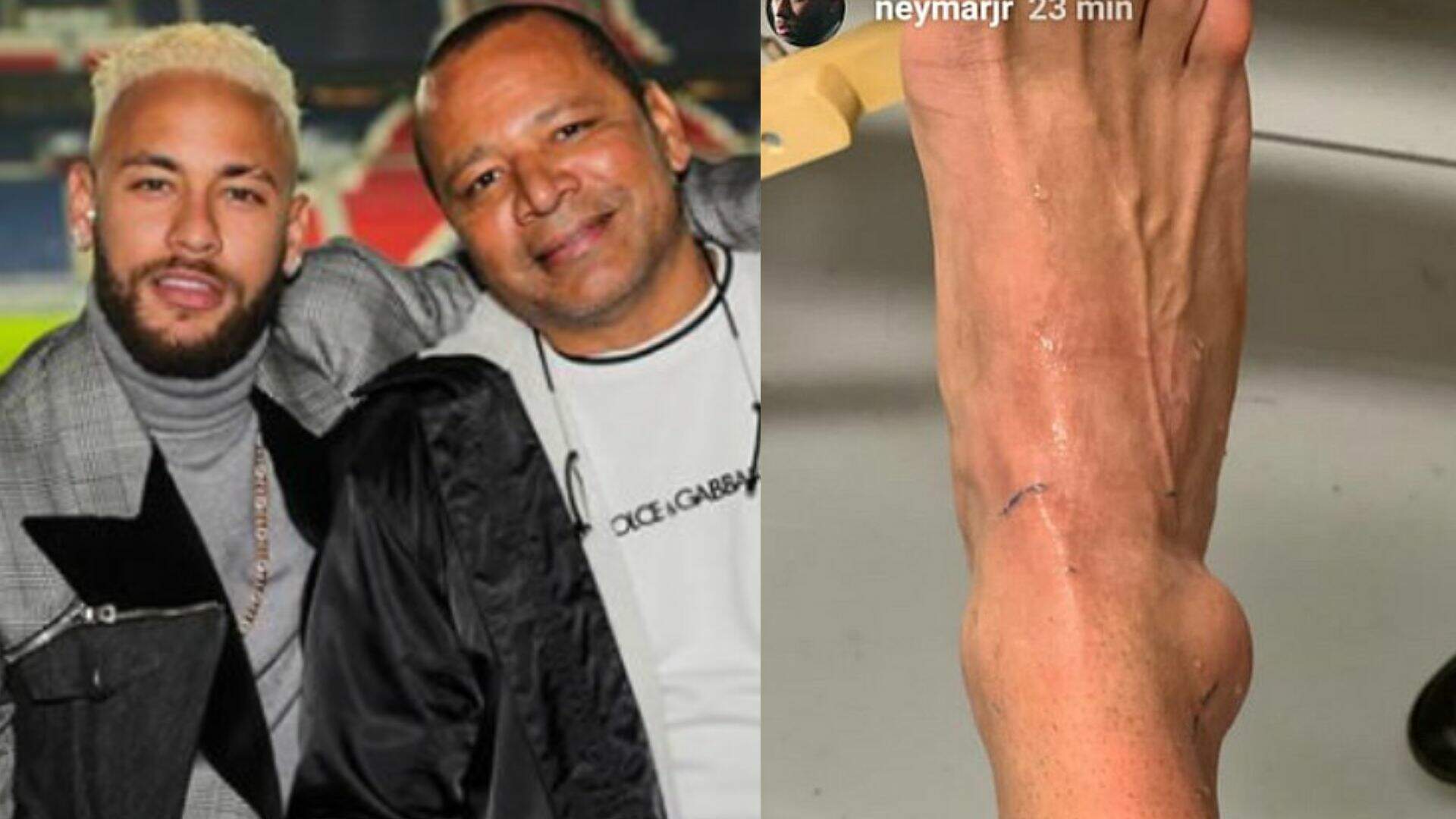Se pronunciou! Pai de Neymar faz declaração após craque sofrer lesão e ficar fora de jogo na Copa