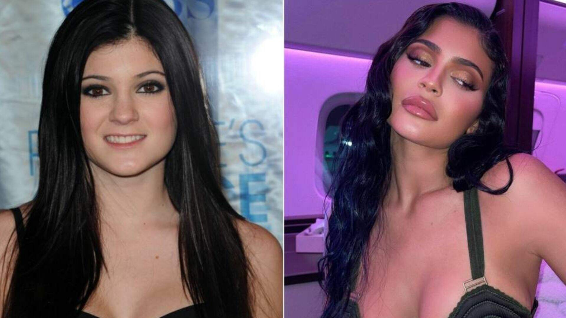 Kylie Jenner nega ter feito cirurgias plásticas por insegurança: “Sempre fui a mais confiante”