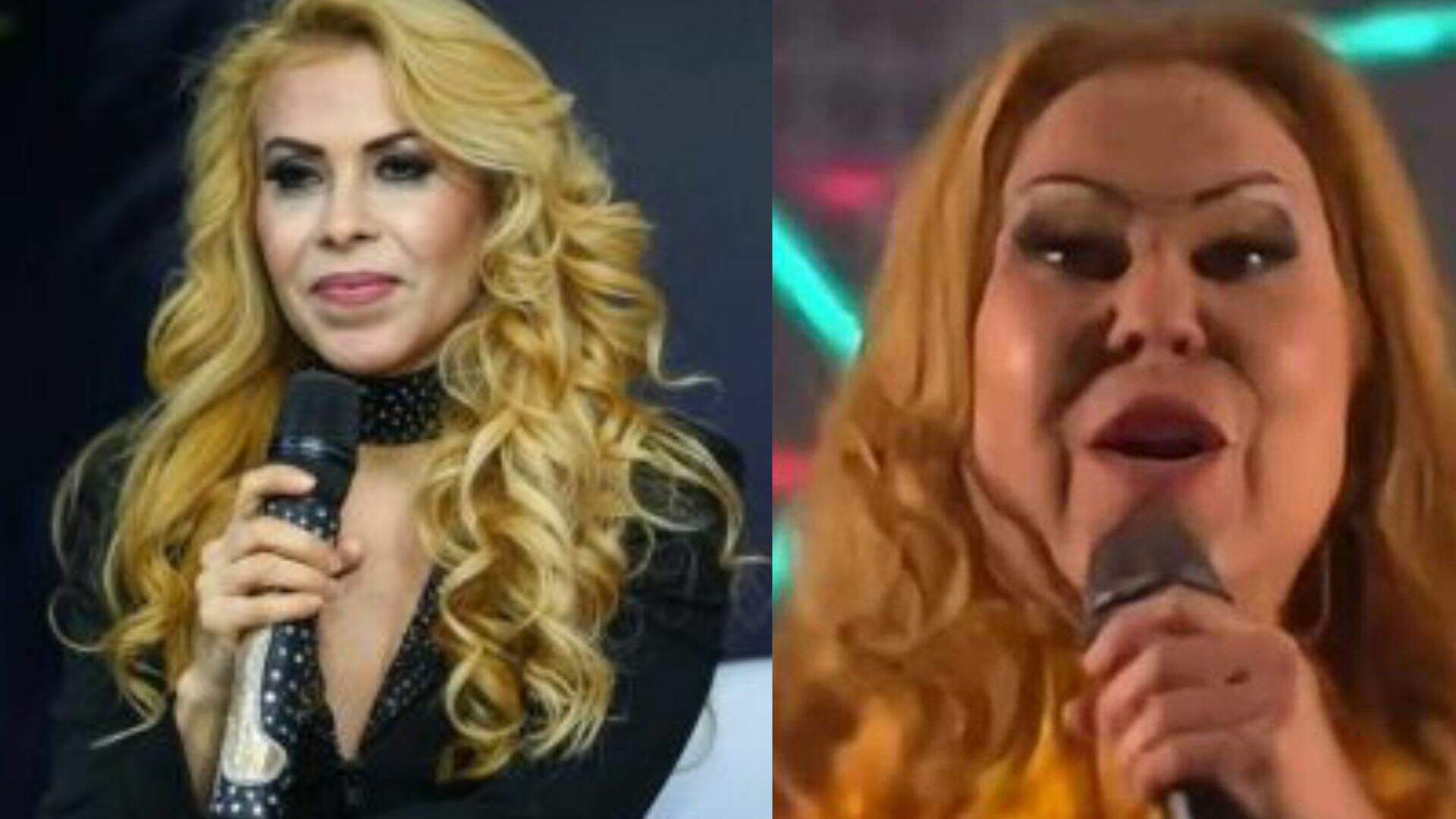 O que Joelma tem? Após exames, cantora descobre real problema de saúde que deixou seu rosto inchado - Metropolitana FM