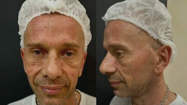 Vin Diesel brasileiro? Rafael Ilha faz harmonização facial no ‘Fofocalizando’ e surge irreconhecível ao vivo