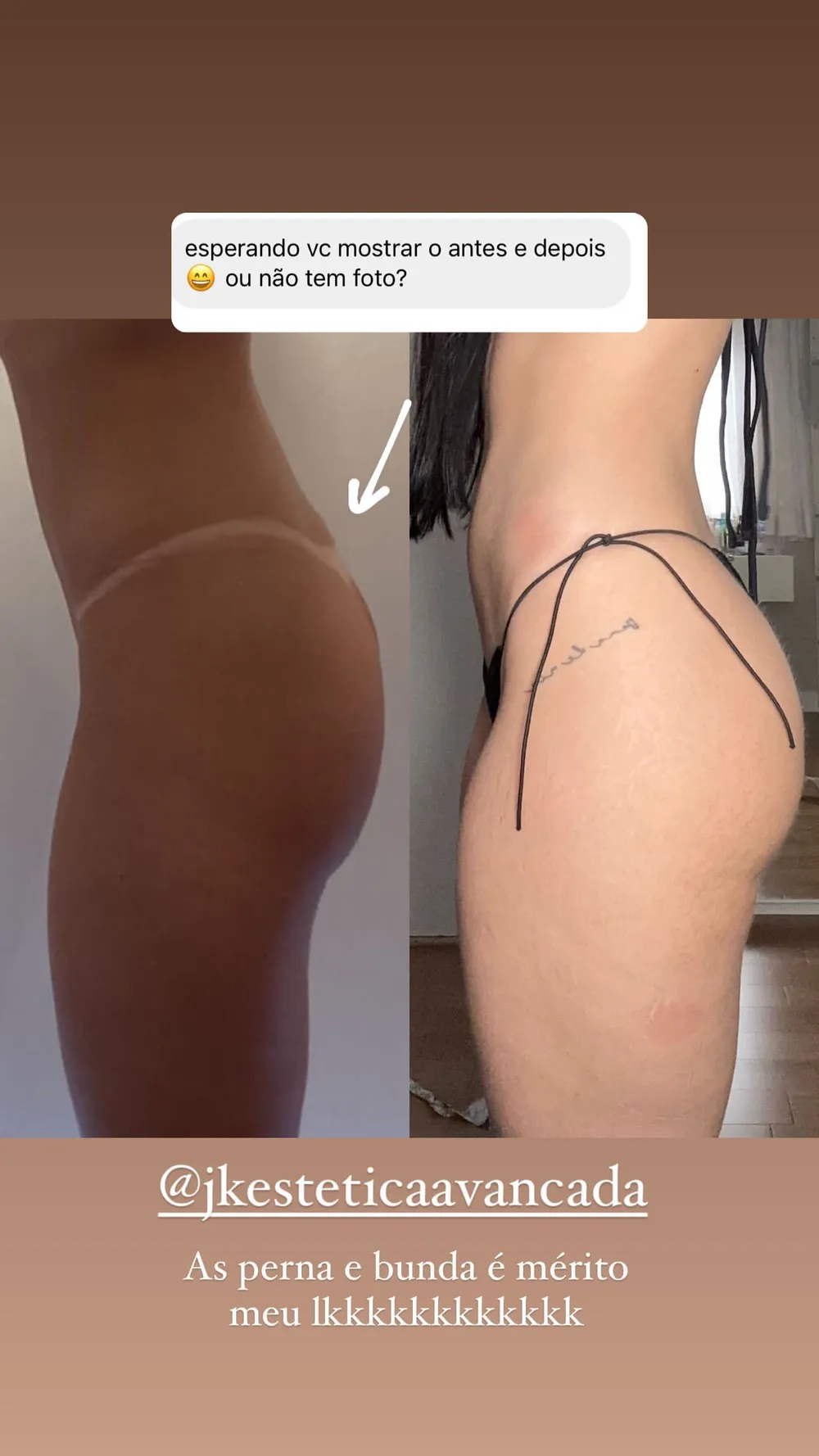 Maria Lina mostra antes e depois de cirurgias plásticas