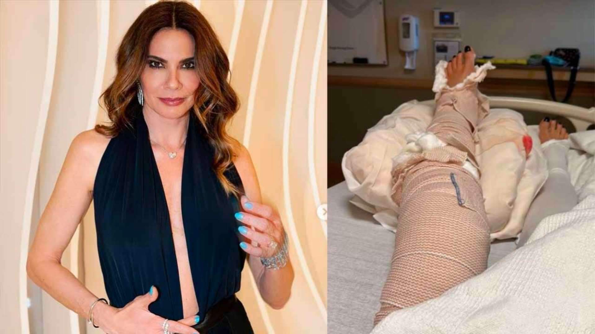 Após quase um ano de acidente, Luciana Gimenez volta ao hospital e desabafa: “Colocaram haste e cinco parafusos” - Metropolitana FM
