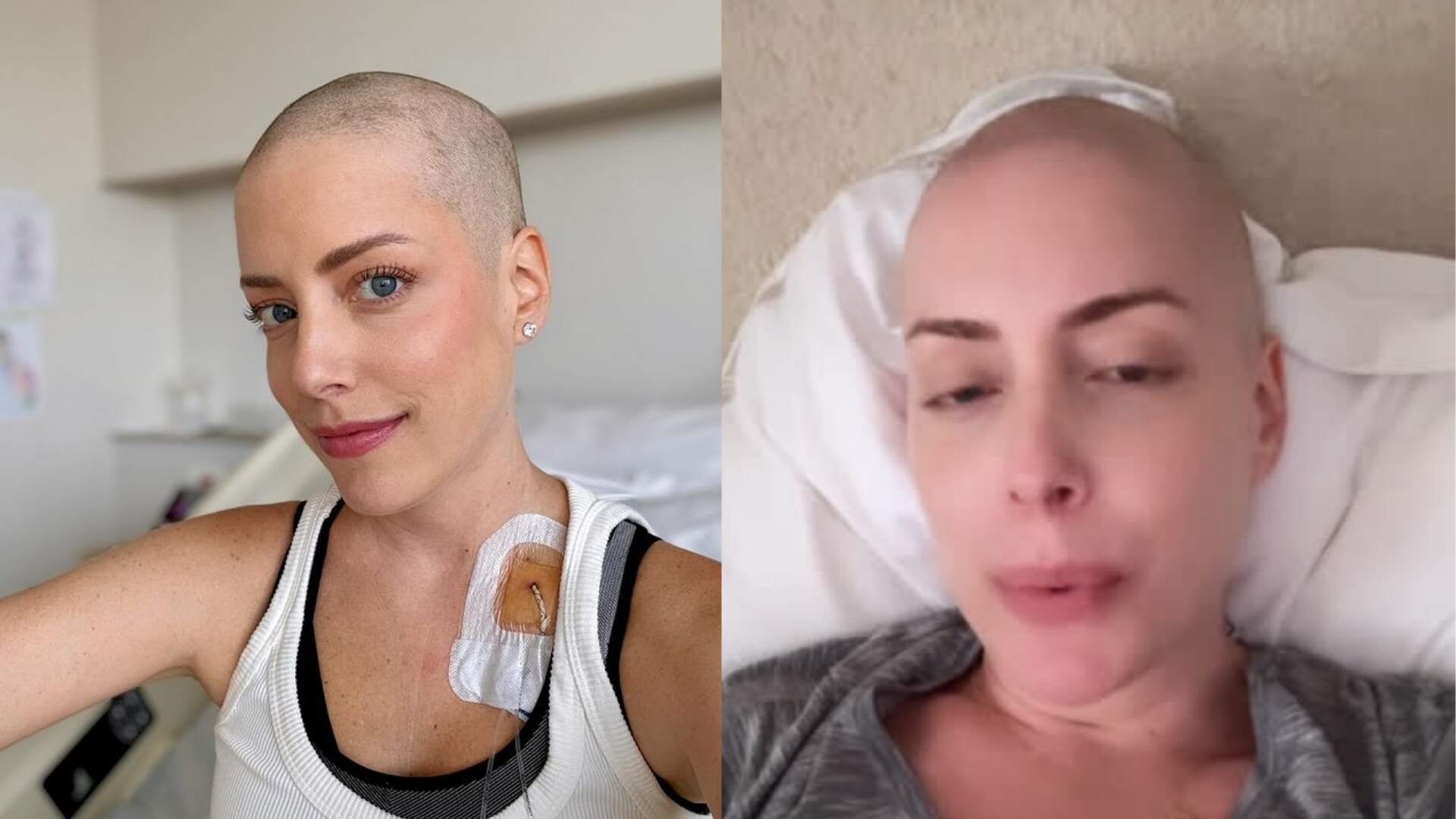 Nas redes sociais, Fabiana Justus revela nova etapa de tratamento contra leucemia
