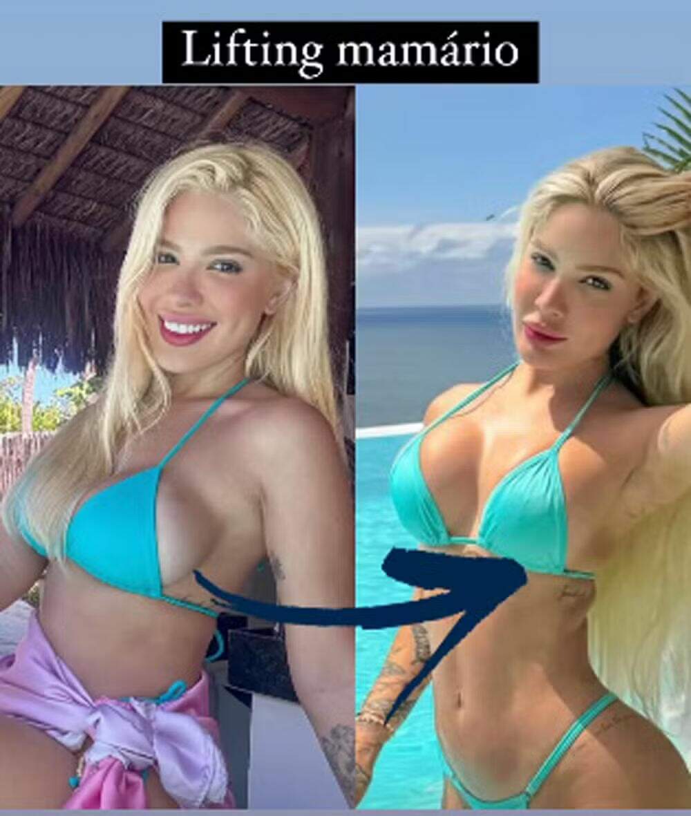 Antes e depois de Karoline Lima