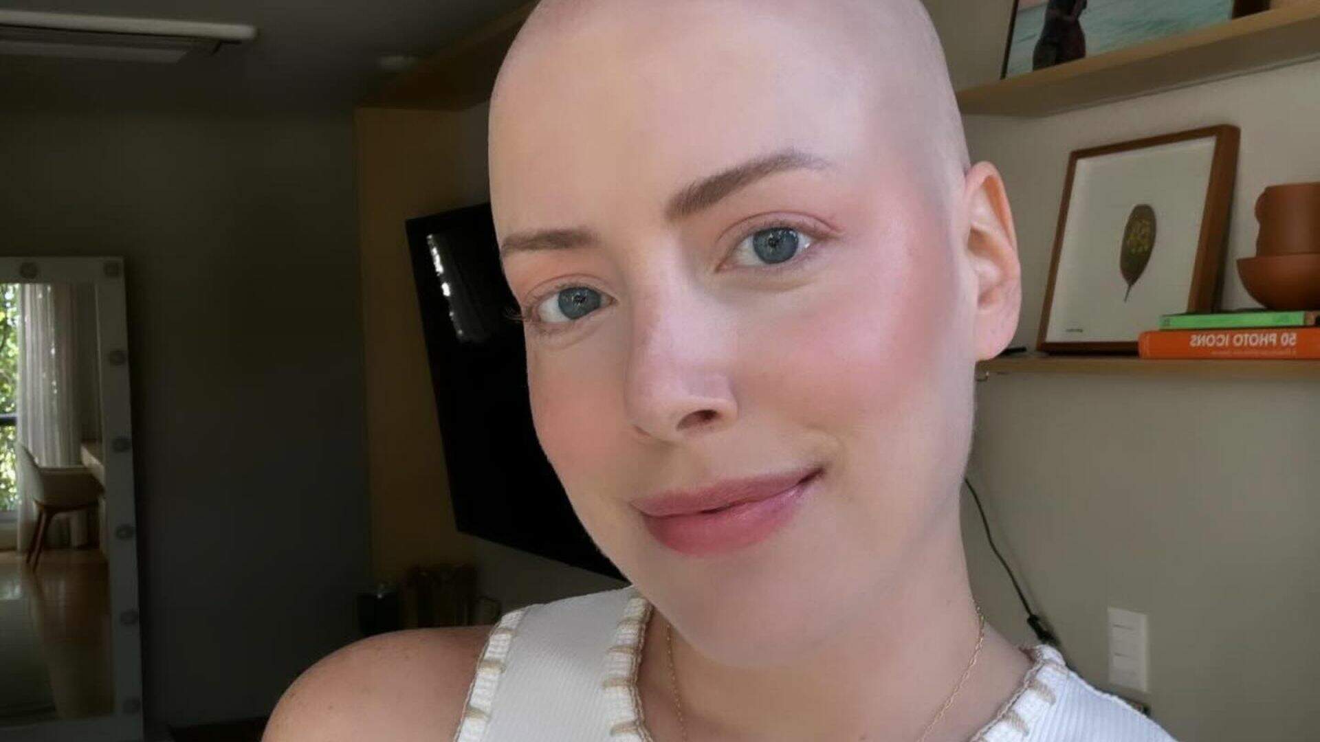 Após perder cabelo durante tratamento contra o câncer, Fabiana Justus reflete: “Minha menor preocupação”