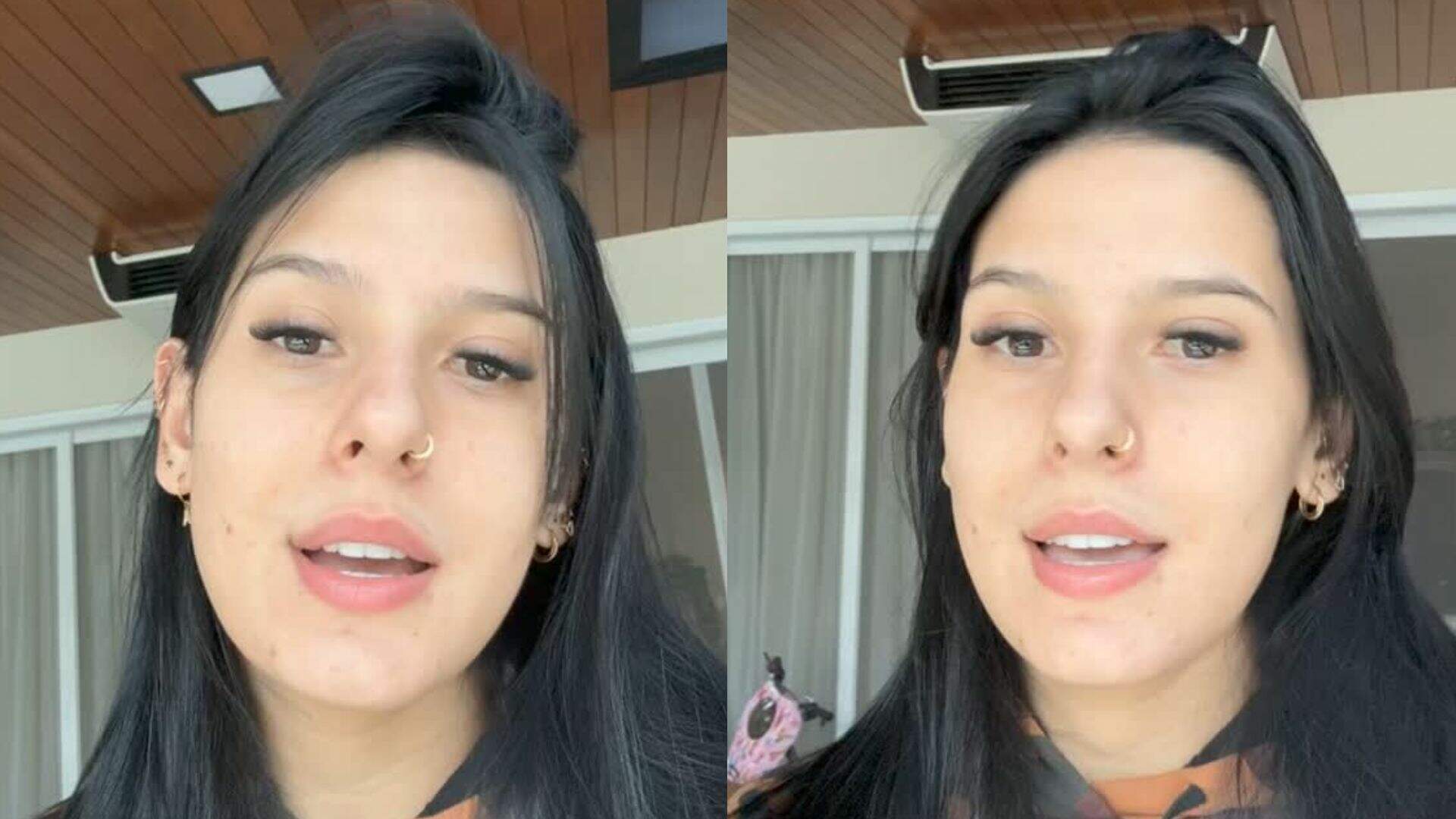Ana Castela fala sobre autoestima ao mostrar antes e depois de tratamento para espinhas; veja a evolução - Metropolitana FM