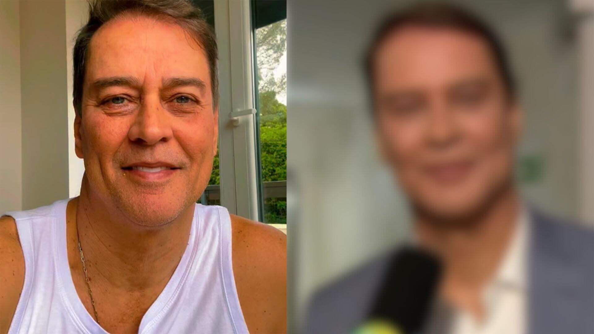 Aos 59 anos, Marcello Antony faz harmonização facial e choca ao mostrar resultado