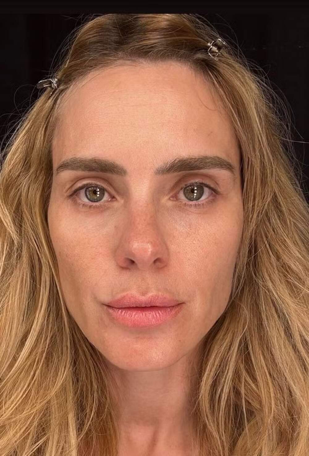 Aos 45 anos, Carolina Dieckmann impressiona ao mostrar sua pele real em selfie sem filtro