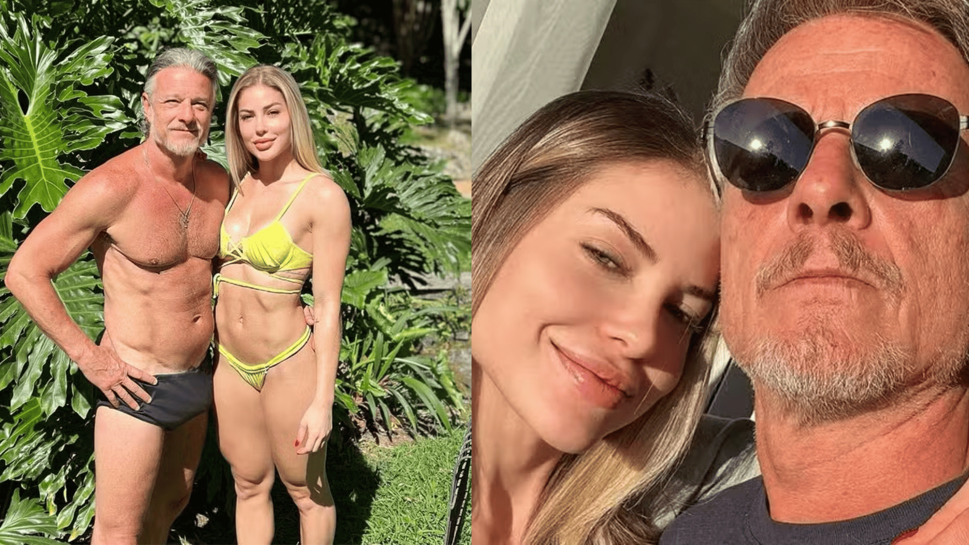 Ex revela que Marcello Novaes terminou com ela após procedimento no bumbum