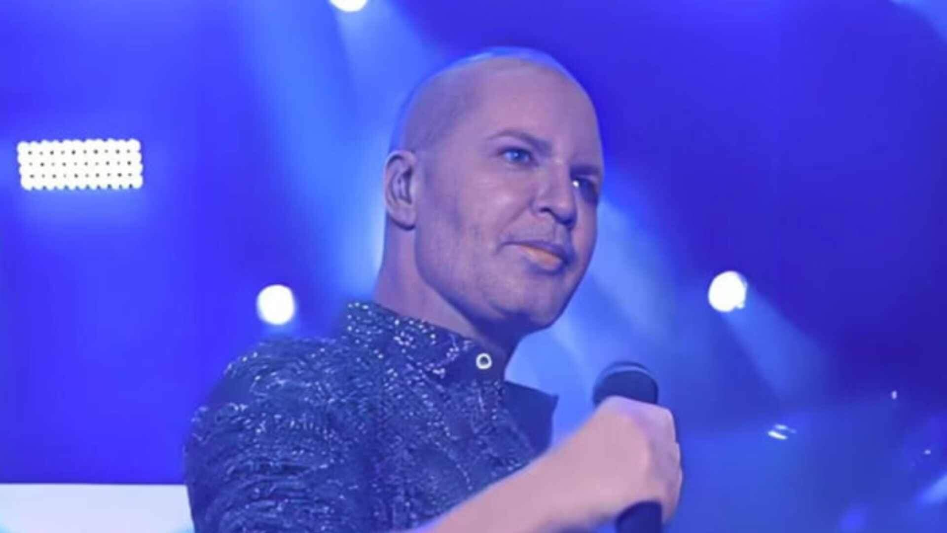 Eduardo Costa exibe novo visual careca e revela motivo do transplante capilar
