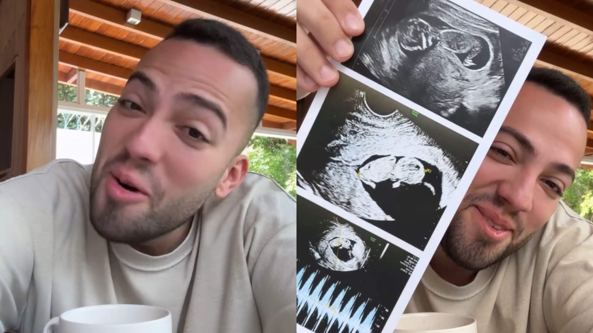 Lucas Rangel comemora paternidade e diz que foi difícil esconder notícia