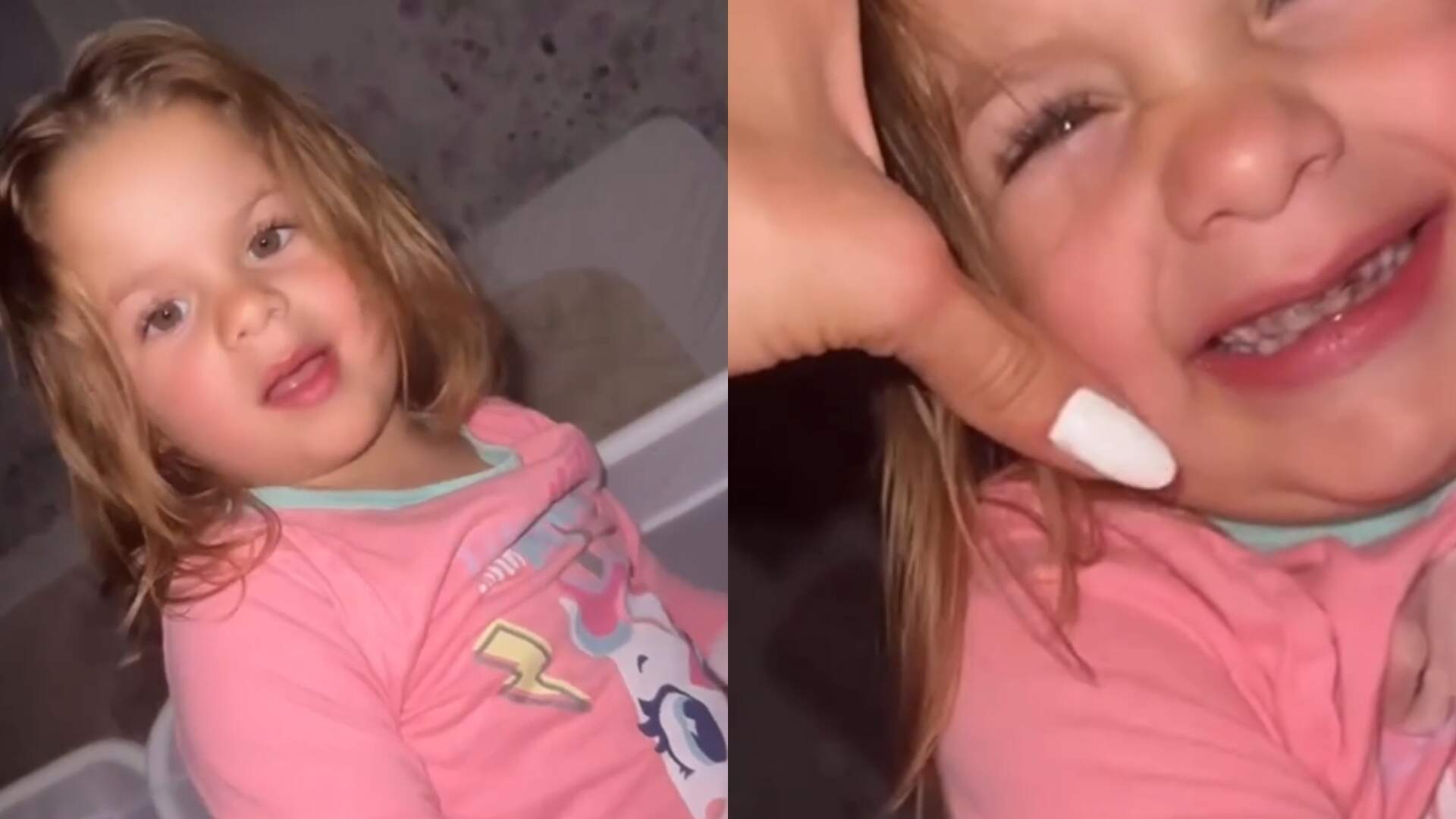 Maria Flor coloca contenção no dente após acidente em casa