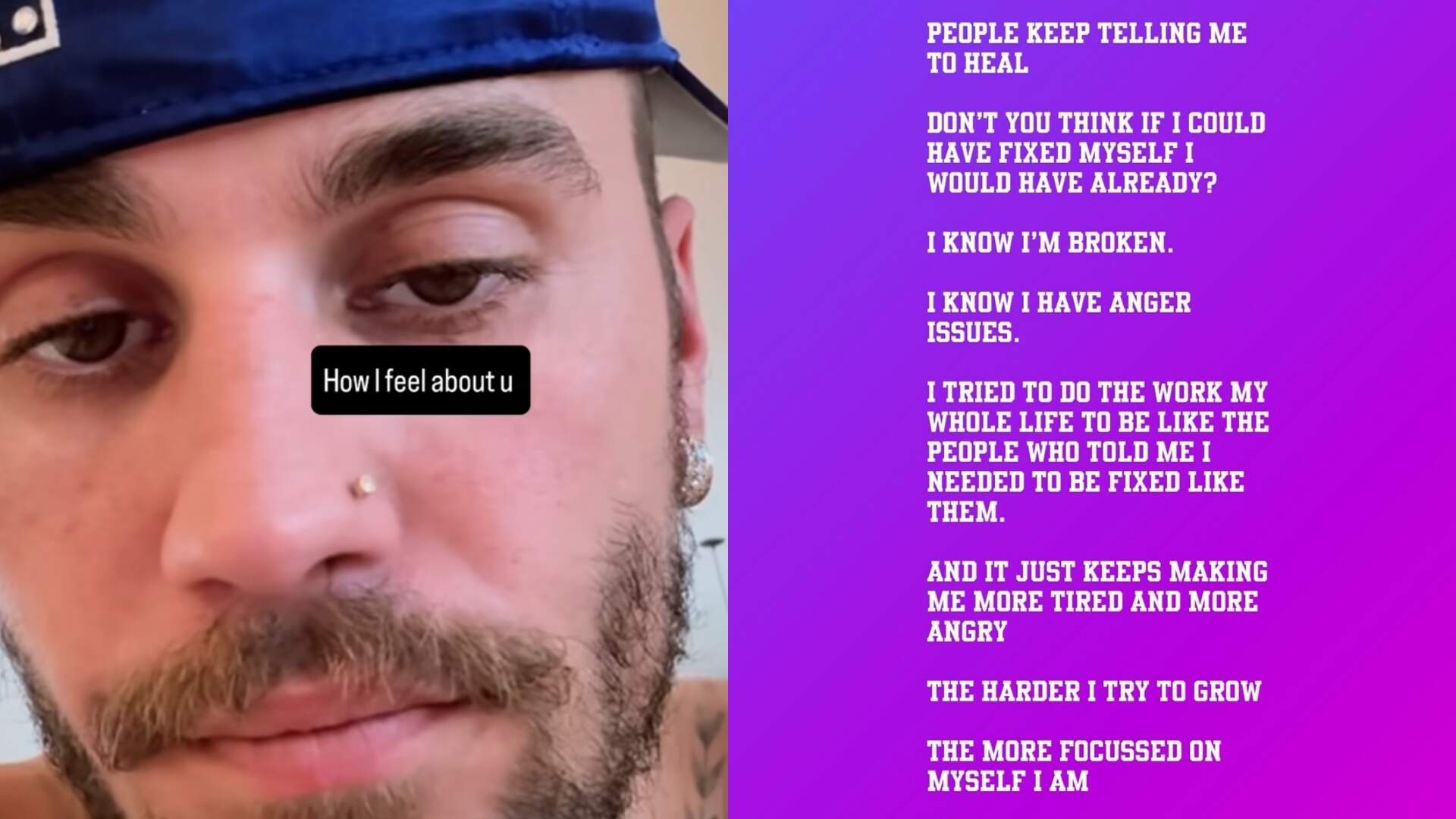 Justin Bieber desabafa sobre exaustão emocional e fala em “estar quebrado”