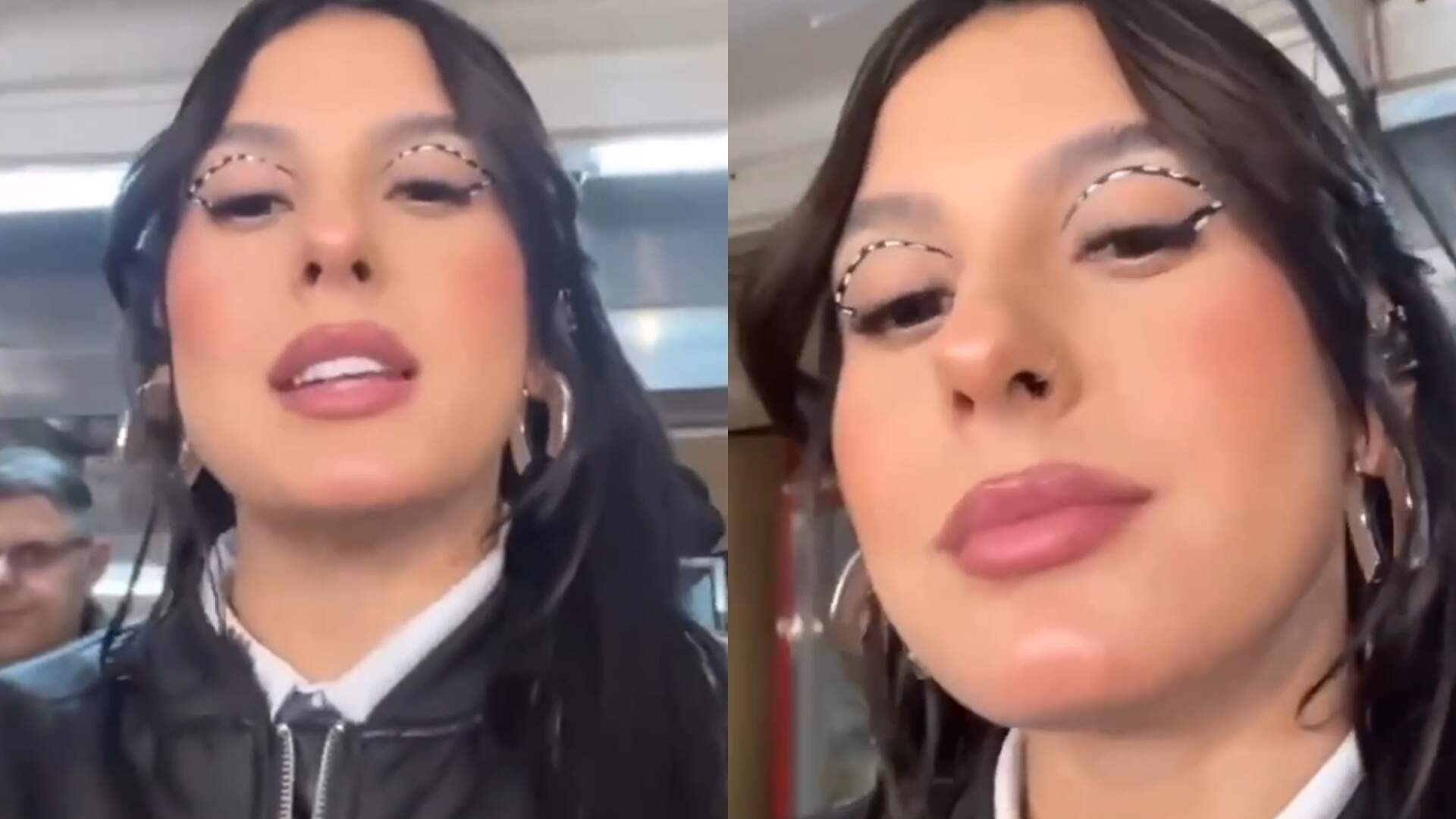 Ana Castela rebate críticas e nega procedimento estético: “Eu sou linda natural”